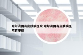 哈尔滨国有皮肤病医院 哈尔滨国有皮肤病医院有哪些