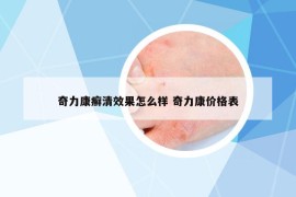 奇力康癣清效果怎么样 奇力康价格表