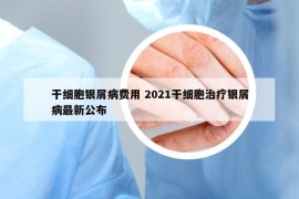 干细胞银屑病费用 2021干细胞治疗银屑病最新公布