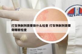 打生物制剂需要做什么检查 打生物制剂需要做哪些检查