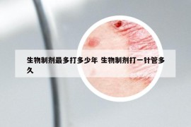 生物制剂最多打多少年 生物制剂打一针管多久