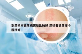 到昆明市银屑病医院比较好 昆明看银屑哪个医院好