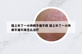 腿上长了一小块癣不痛不痒 腿上长了一小块癣不痛不痒怎么治疗