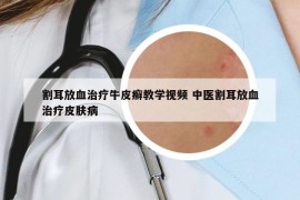 割耳放血治疗牛皮癣教学视频 中医割耳放血治疗皮肤病