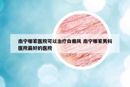 南宁哪家医院可以治疗白癜风 南宁哪家男科医院最好的医院