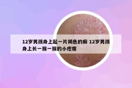 12岁男孩身上起一片褐色的癣 12岁男孩身上长一簇一簇的小疙瘩