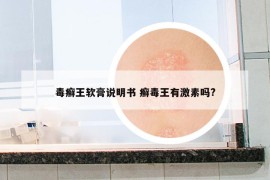 毒癣王软膏说明书 癣毒王有激素吗?