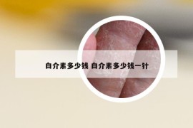 白介素多少钱 白介素多少钱一针