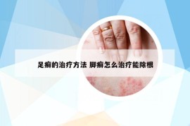 足癣的治疗方法 脚癣怎么治疗能除根