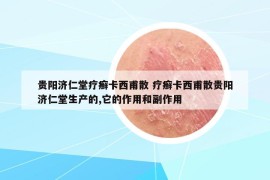 贵阳济仁堂疗癣卡西甫散 疗癣卡西甫散贵阳济仁堂生产的,它的作用和副作用