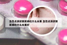 急性点滴状银屑病吃什么水果 急性点滴状银屑病吃什么水果好