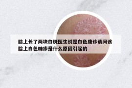 脸上长了两块白斑医生说是白色康诊请问该 脸上白色糠疹是什么原因引起的