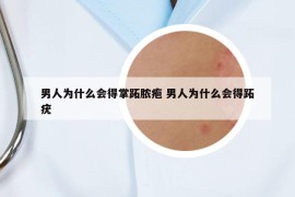 男人为什么会得掌跖脓疱 男人为什么会得跖疣