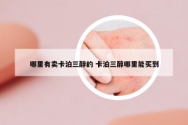 哪里有卖卡泊三醇的 卡泊三醇哪里能买到