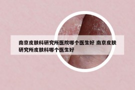 南京皮肤科研究所医院哪个医生好 南京皮肤研究所皮肤科哪个医生好