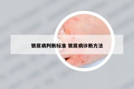 银屑病判断标准 银屑病诊断方法