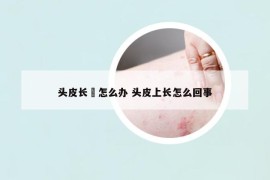 头皮长廯怎么办 头皮上长怎么回事