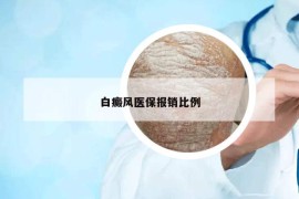 白癜风医保报销比例