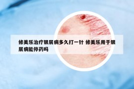 修美乐治疗银屑病多久打一针 修美乐用于银屑病能停药吗