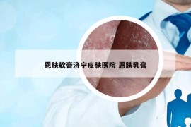 恩肤软膏济宁皮肤医院 恩肤乳膏