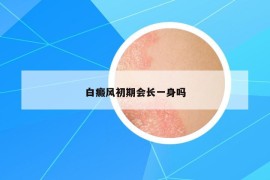 白癜风初期会长一身吗