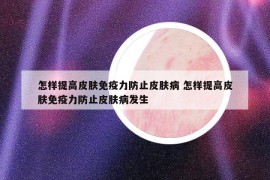 怎样提高皮肤免疫力防止皮肤病 怎样提高皮肤免疫力防止皮肤病发生