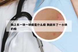 胸上长一块一块癣是什么癣 胸前长了一小块的癣