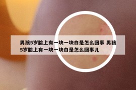 男孩5岁脸上有一块一块白是怎么回事 男孩5岁脸上有一块一块白是怎么回事儿