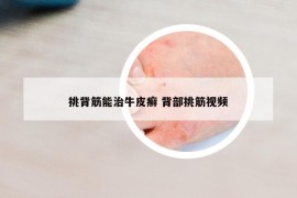 挑背筋能治牛皮癣 背部挑筋视频