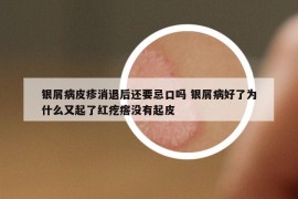 银屑病皮疹消退后还要忌口吗 银屑病好了为什么又起了红疙瘩没有起皮