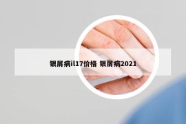 银屑病il17价格 银屑病2021