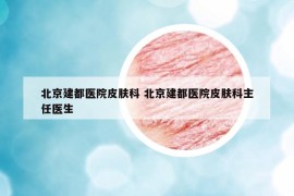 北京建都医院皮肤科 北京建都医院皮肤科主任医生