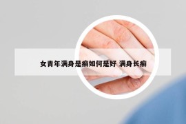 女青年满身是癣如何是好 满身长癣