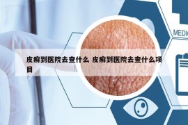 皮癣到医院去查什么 皮癣到医院去查什么项目