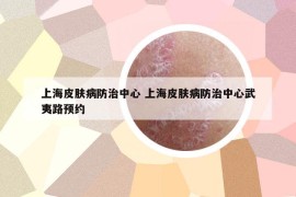 上海皮肤病防治中心 上海皮肤病防治中心武夷路预约