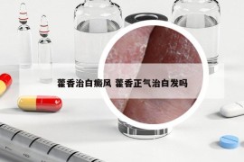 藿香治白癜风 藿香正气治白发吗