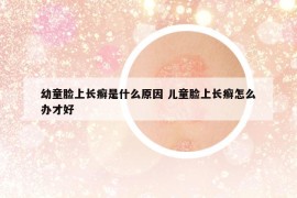 幼童脸上长癣是什么原因 儿童脸上长癣怎么办才好