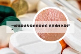 一般银屑病多长时间能好吗 银屑病多久能好?