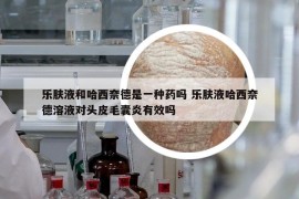 乐肤液和哈西奈德是一种药吗 乐肤液哈西奈德溶液对头皮毛囊炎有效吗