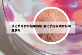 消化系统会引起银屑病 消化系统疾病会影响皮肤吗