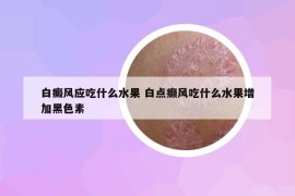 白癜风应吃什么水果 白点癫风吃什么水果增加黑色素