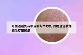 丹栀逍遥丸与牛皮癣与二妙丸 丹栀逍遥散加减治疗银屑病