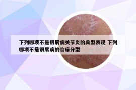 下列哪项不是银屑病关节炎的典型表现 下列哪项不是银屑病的临床分型