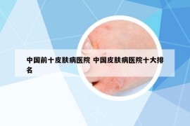 中国前十皮肤病医院 中国皮肤病医院十大排名