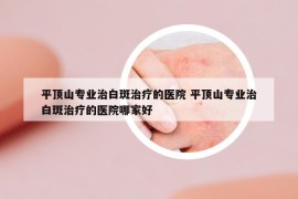 平顶山专业治白斑治疗的医院 平顶山专业治白斑治疗的医院哪家好