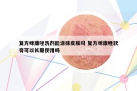 复方咪康唑洗剂能涂抹皮肤吗 复方咪康唑软膏可以长期使用吗