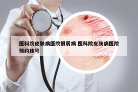 医科院皮肤病医院银屑病 医科院皮肤病医院预约挂号