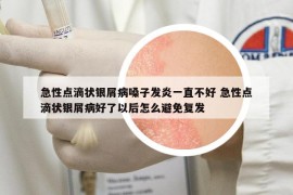 急性点滴状银屑病嗓子发炎一直不好 急性点滴状银屑病好了以后怎么避免复发