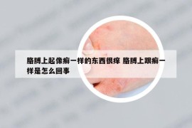 胳膊上起像癣一样的东西很痒 胳膊上跟癣一样是怎么回事