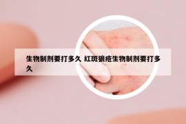 生物制剂要打多久 红斑狼疮生物制剂要打多久